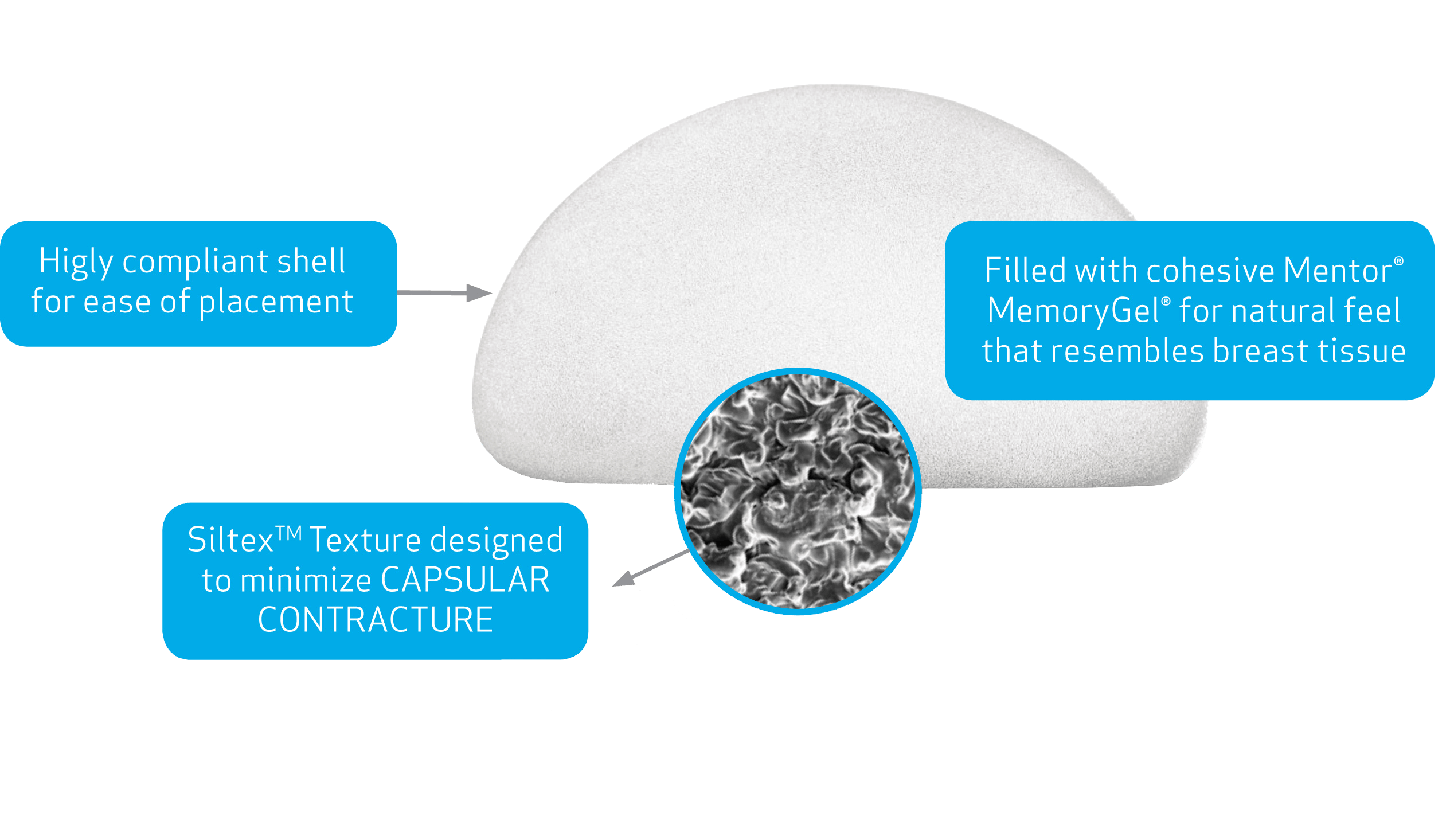 Kulaté prsní implantáty